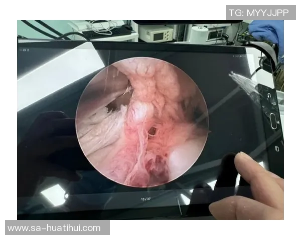 马卡：医学专家认可加维手术方案，缝合半月板可延长运动生涯